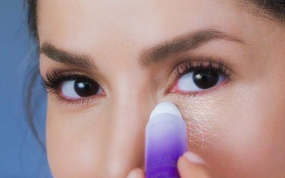 Principales causas de las ojeras